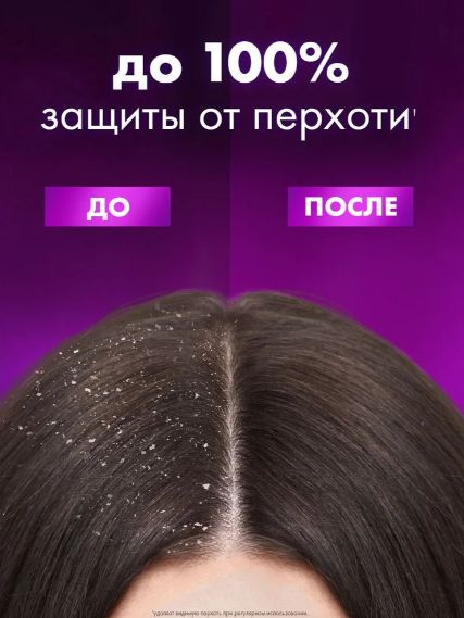 Шампунь для женщин Клиар Phytotechnology с экстрактами лекарственных растений против перхоти 400 мл